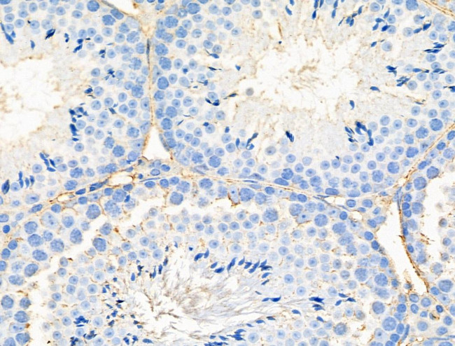 Neurocan Antibody in Immunohistochemistry (Paraffin) (IHC (P))