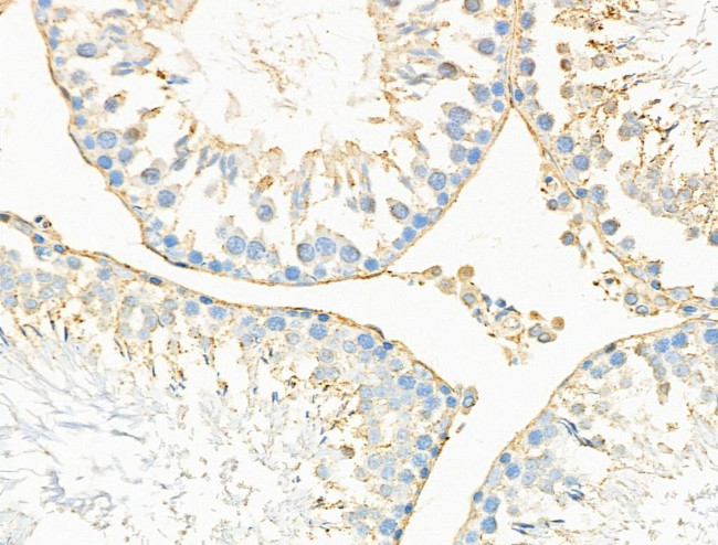 Neurocan Antibody in Immunohistochemistry (Paraffin) (IHC (P))