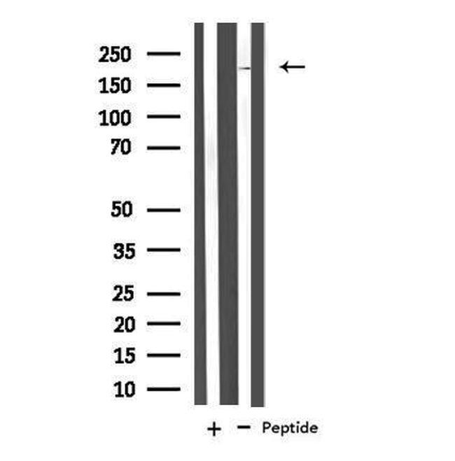 Neurocan Antibody in Western Blot (WB)