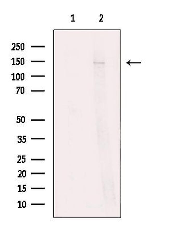 Neurocan Antibody in Western Blot (WB)