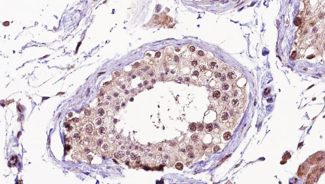 NUSAP1 Antibody in Immunohistochemistry (Paraffin) (IHC (P))