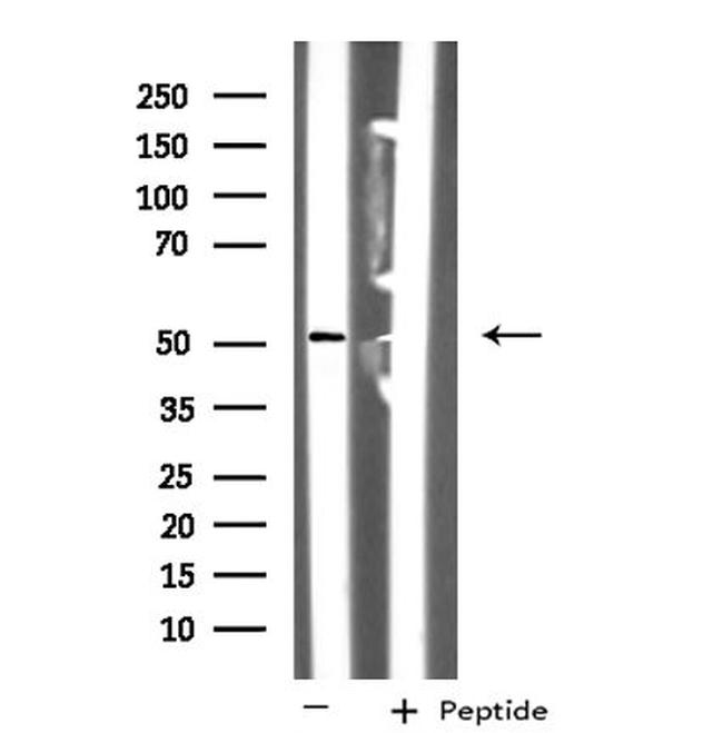 NUSAP1 Antibody in Western Blot (WB)