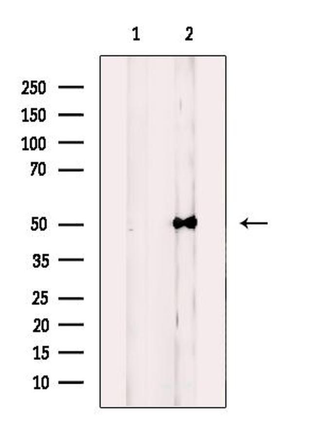 NUSAP1 Antibody in Western Blot (WB)