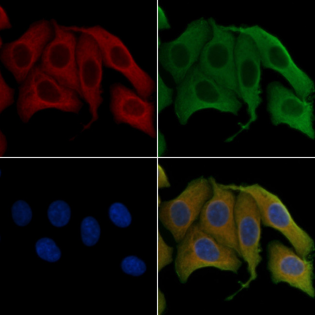 OAT Antibody in Immunocytochemistry (ICC/IF)