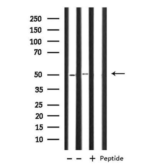 OAT Antibody in Western Blot (WB)