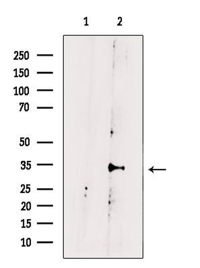 KCNK6 Antibody in Western Blot (WB)