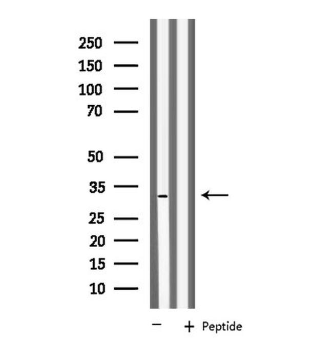 KCNK6 Antibody in Western Blot (WB)