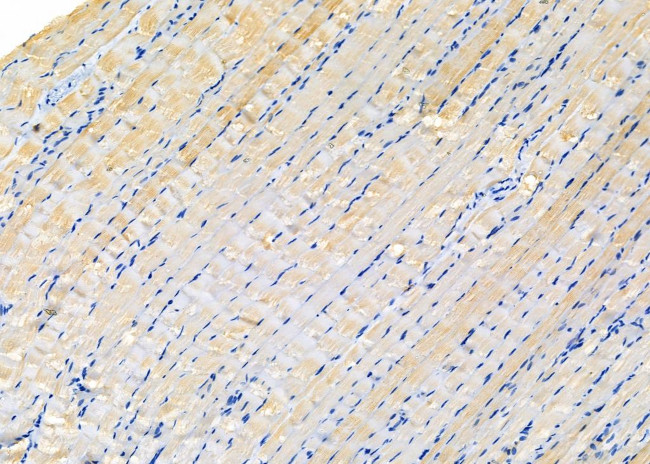 KCNK7 Antibody in Immunohistochemistry (Paraffin) (IHC (P))