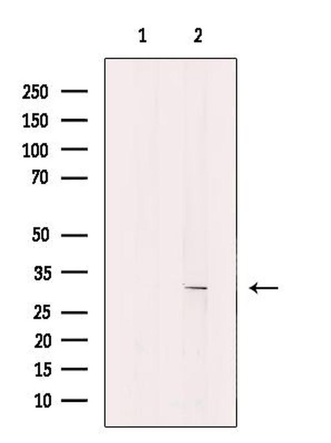 KCNK7 Antibody in Western Blot (WB)