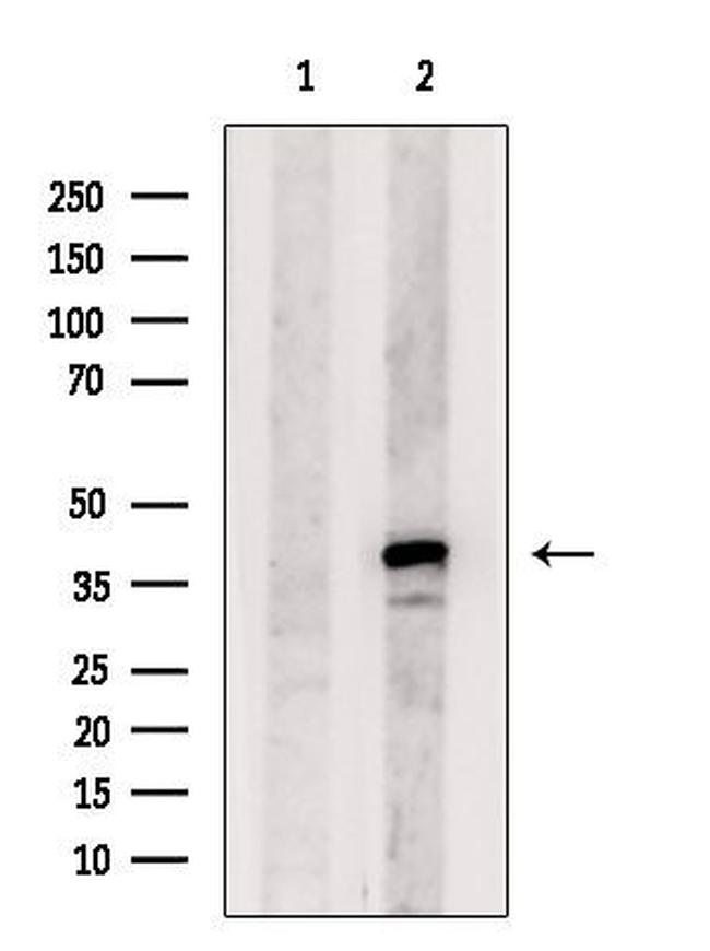 KCNK7 Antibody in Western Blot (WB)