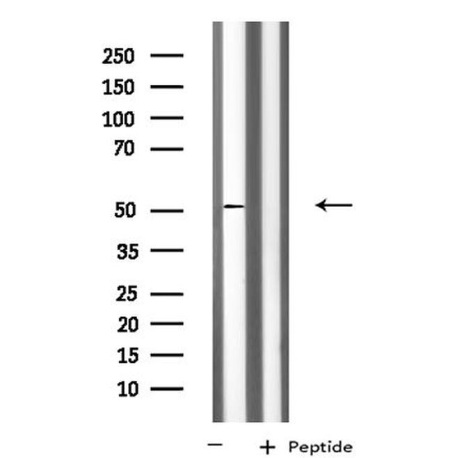 KCNG3 Antibody in Western Blot (WB)