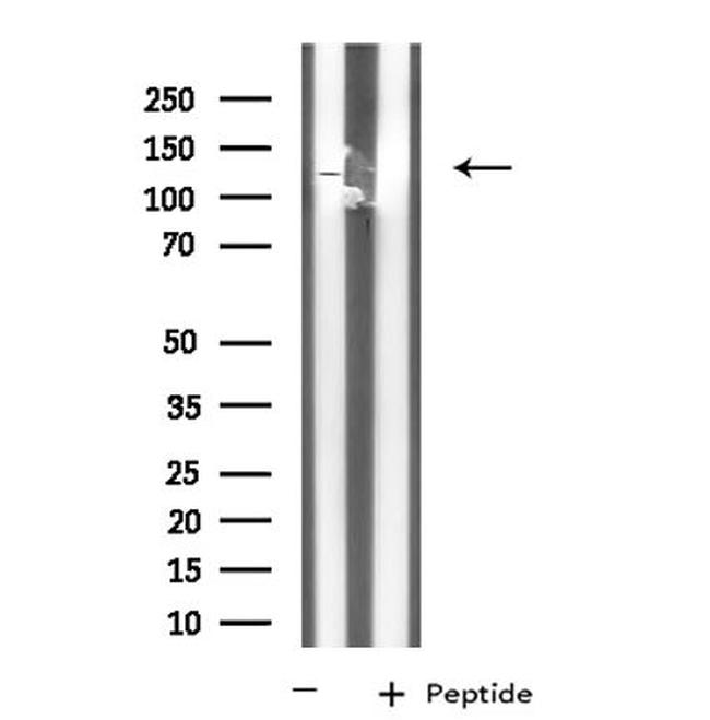 KCNH3 Antibody in Western Blot (WB)