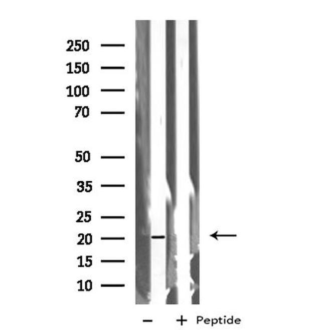 BTC Antibody in Western Blot (WB)