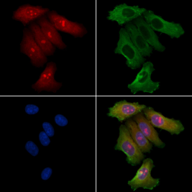 FNTB Antibody in Immunocytochemistry (ICC/IF)