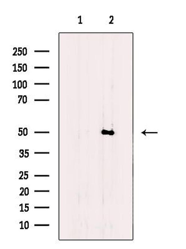 FNTB Antibody in Western Blot (WB)