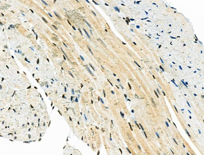 PDK1 Antibody in Immunohistochemistry (Paraffin) (IHC (P))