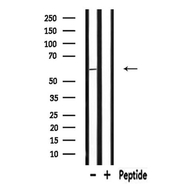 RAB11FIP2 Antibody in Western Blot (WB)