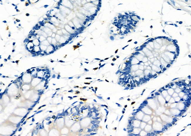 RAB38 Antibody in Immunohistochemistry (Paraffin) (IHC (P))