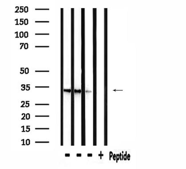 RAB40B Antibody in Western Blot (WB)