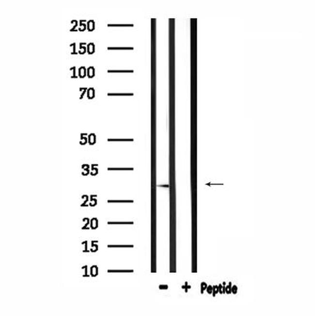 RAB29 Antibody in Western Blot (WB)