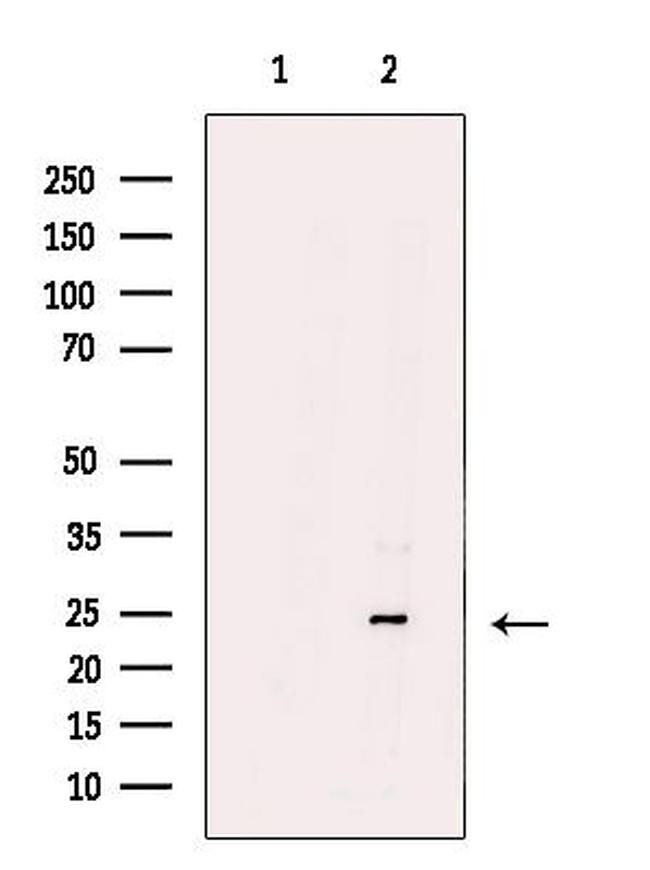 ARHGDIG Antibody in Western Blot (WB)