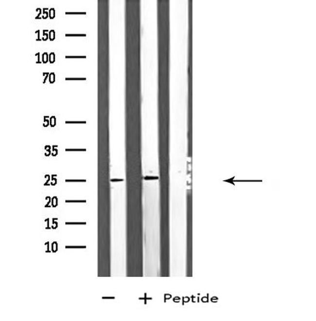 ARHGDIG Antibody in Western Blot (WB)