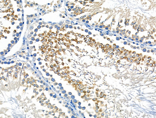 STK36 Antibody in Immunohistochemistry (Paraffin) (IHC (P))