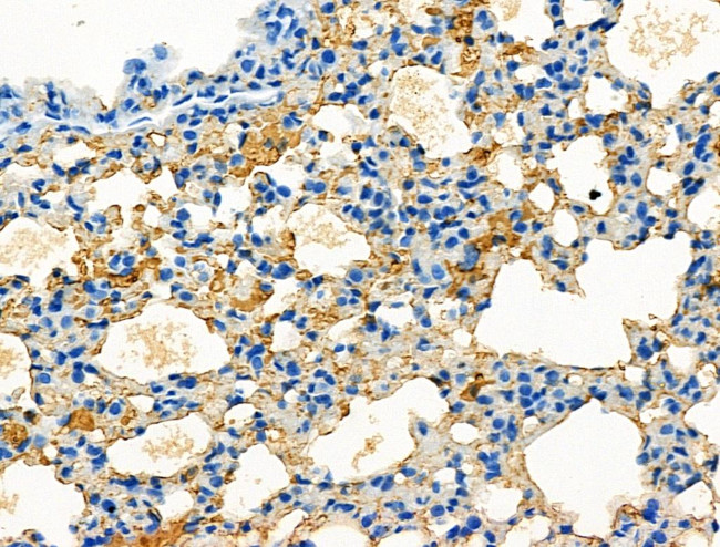 PLK3 Antibody in Immunohistochemistry (Paraffin) (IHC (P))