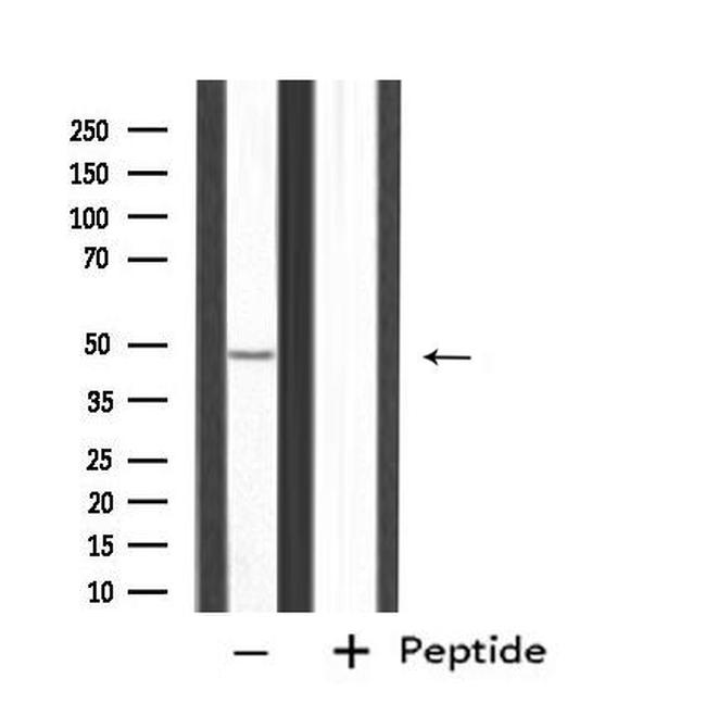 PPP2R2B Antibody in Western Blot (WB)