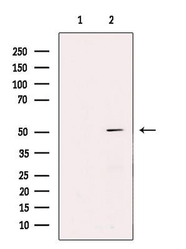 PPP2R2B Antibody in Western Blot (WB)