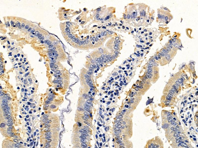 SH2D2A Antibody in Immunohistochemistry (Paraffin) (IHC (P))