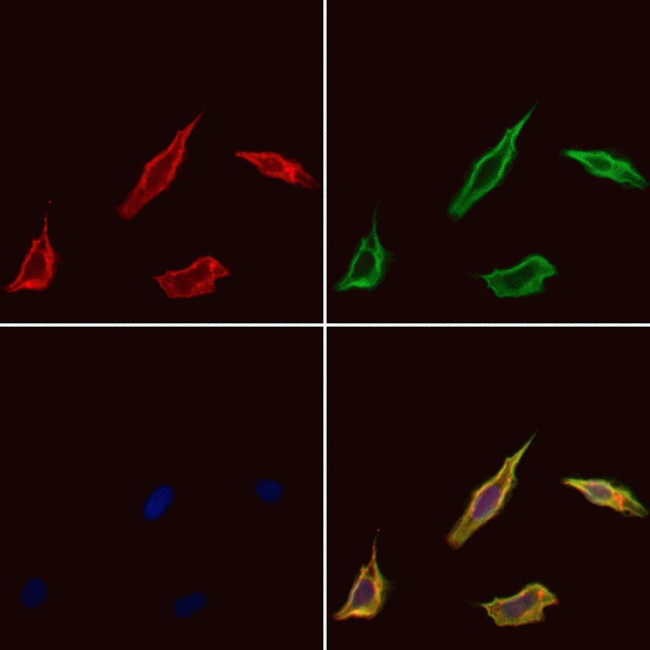 SCK Antibody in Immunocytochemistry (ICC/IF)