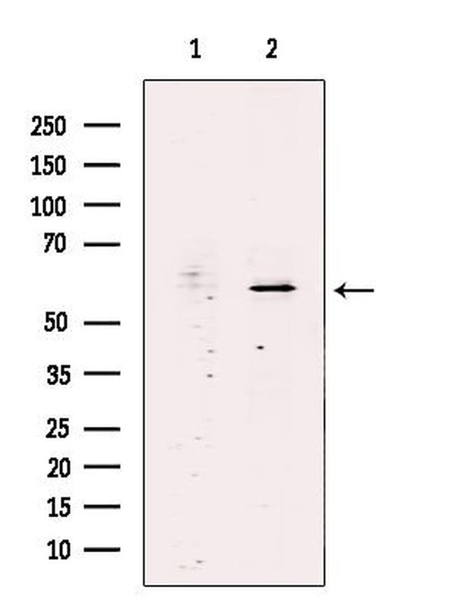 SCK Antibody in Western Blot (WB)