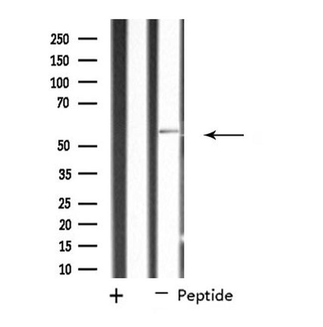 SCK Antibody in Western Blot (WB)