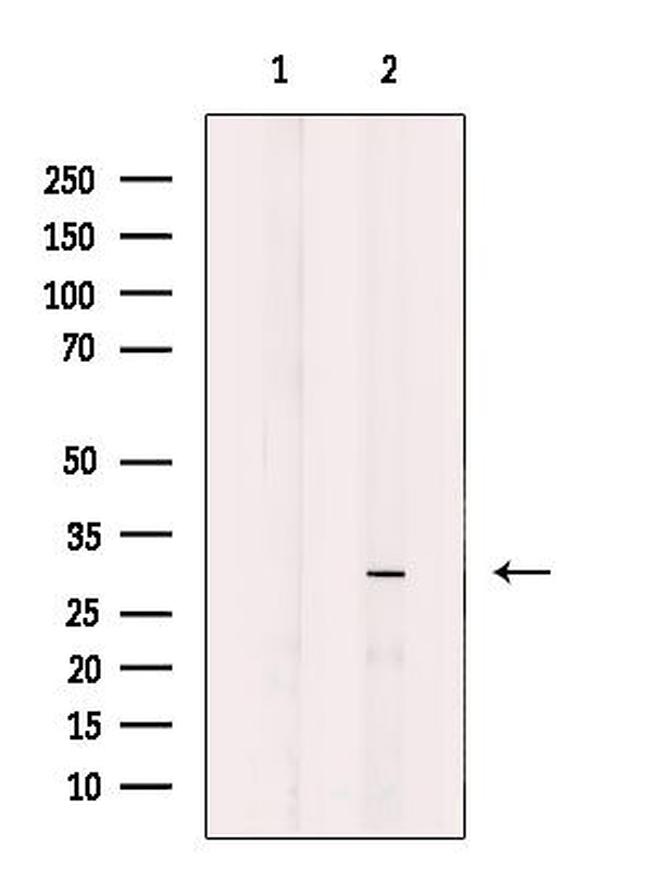 CD298 Antibody in Western Blot (WB)