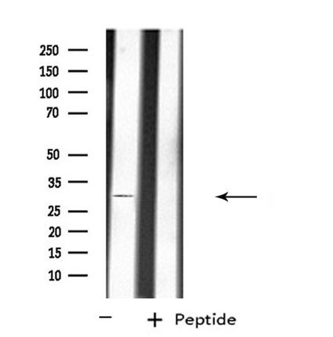 CD298 Antibody in Western Blot (WB)