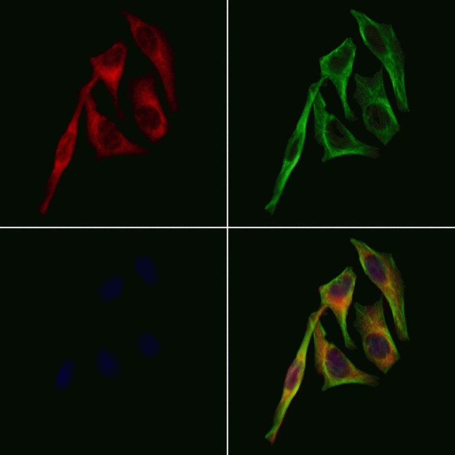 Dopamine Transporter Antibody in Immunocytochemistry (ICC/IF)