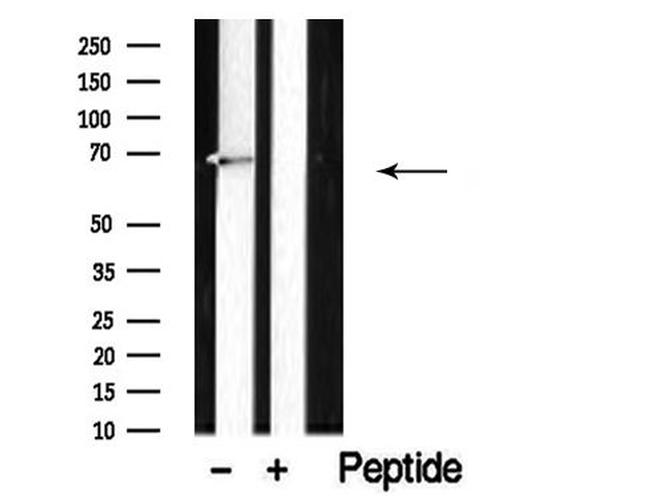 Dopamine Transporter Antibody in Western Blot (WB)