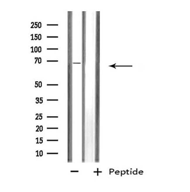 Dopamine Transporter Antibody in Western Blot (WB)