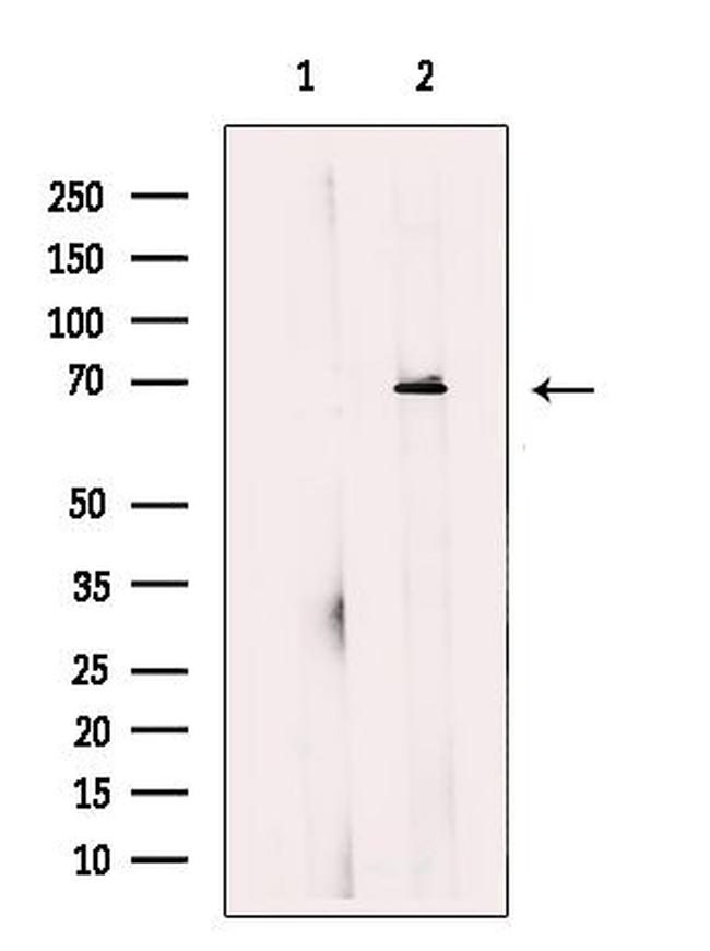 Dopamine Transporter Antibody in Western Blot (WB)