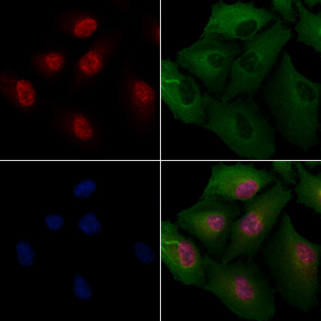 TCF7L1 Antibody in Immunocytochemistry (ICC/IF)