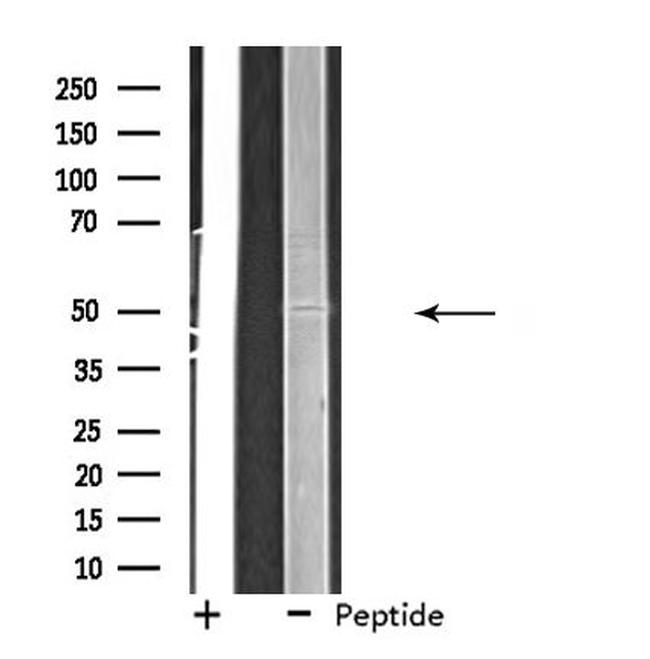 eIF2b gamma Antibody in Western Blot (WB)