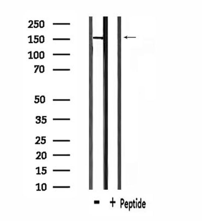 USP42 Antibody in Western Blot (WB)