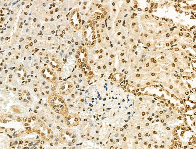 UBAP2L Antibody in Immunohistochemistry (Paraffin) (IHC (P))