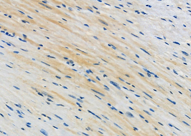 CACNG7 Antibody in Immunohistochemistry (Paraffin) (IHC (P))