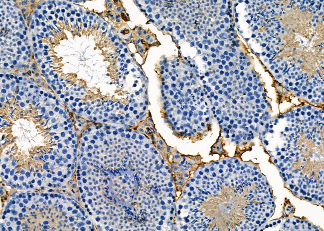 CACNG7 Antibody in Immunohistochemistry (Paraffin) (IHC (P))