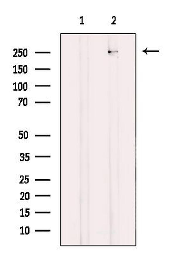 CaV3.2 Antibody in Western Blot (WB)