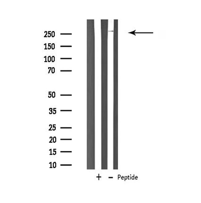 CaV3.2 Antibody in Western Blot (WB)