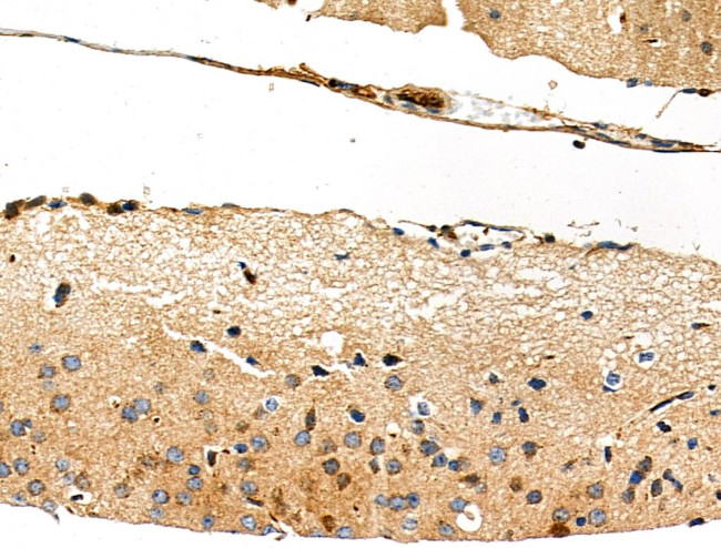 WASF3 Antibody in Immunohistochemistry (Paraffin) (IHC (P))