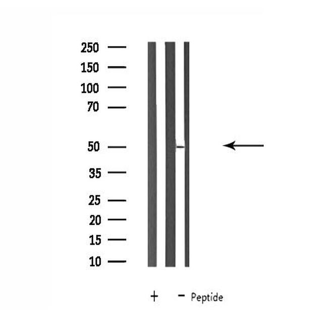 SLC30A4 Antibody in Western Blot (WB)